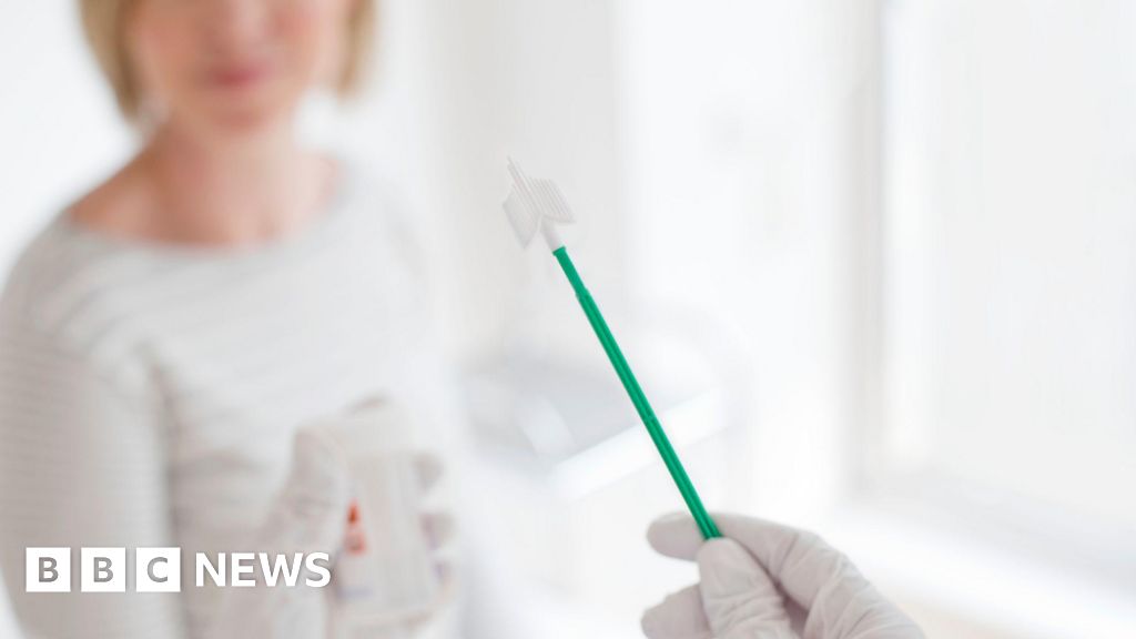 Third of Glasgow women fail to take smear test