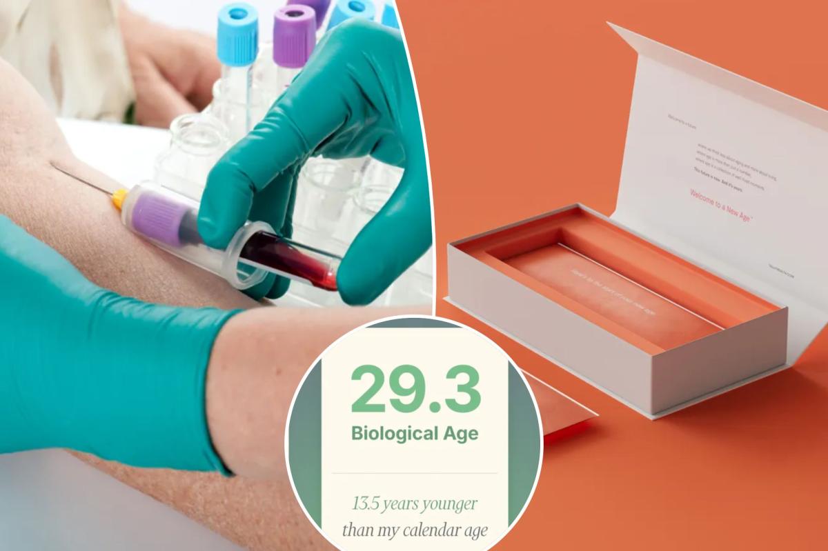 I gave lots of blood for 6 longevity tests  --  here's how long I can...