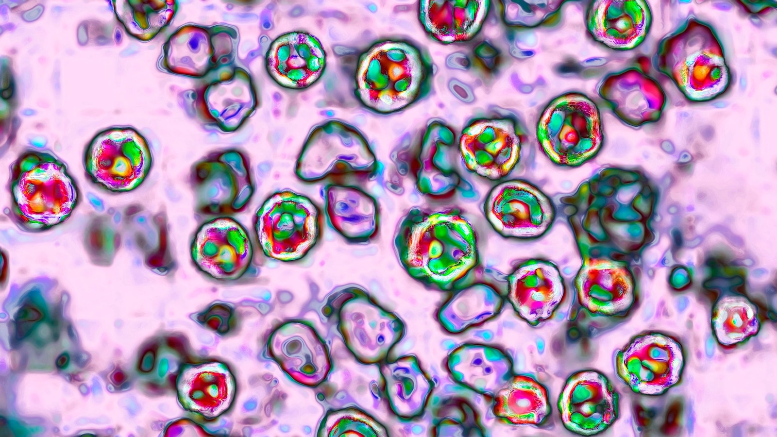 At least 88 new measles cases confirmed in South Carolina, bringing total to 646: Health officials