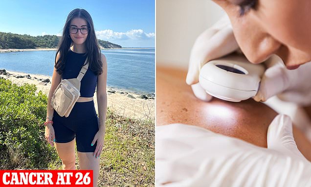 The unexpected place you can get melanoma that isn't your skin