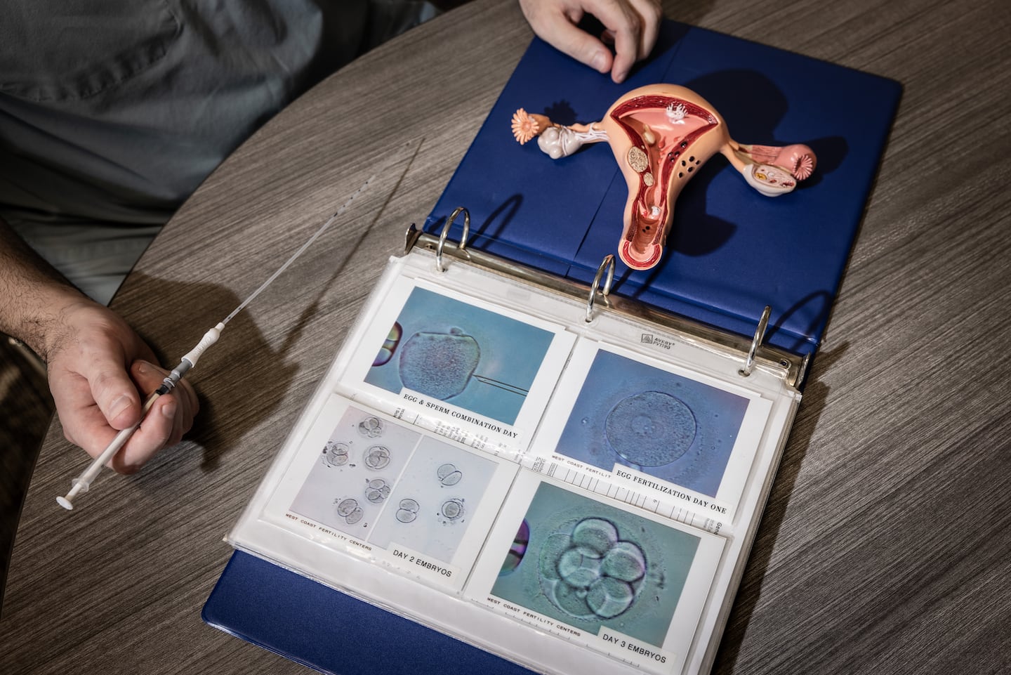 Scientists find new clues to why female fertility declines with age - The Boston Globe