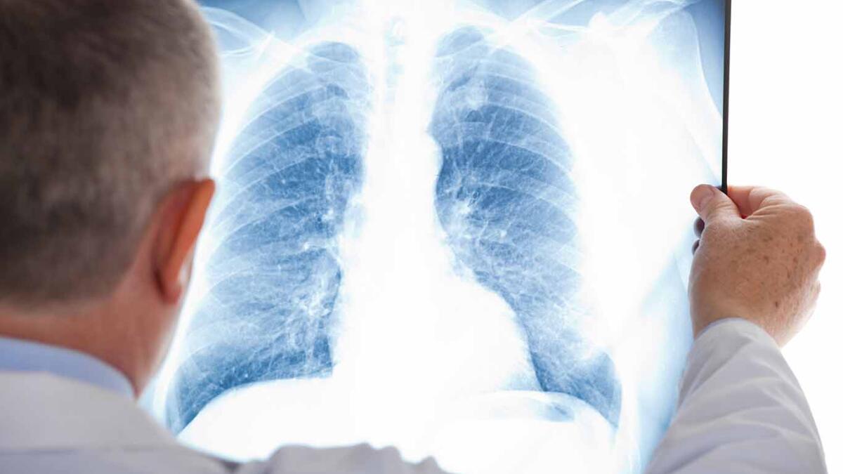 Trethera Awarded $2.7M NIH Grant to Study Lung Cancer Drug Combination