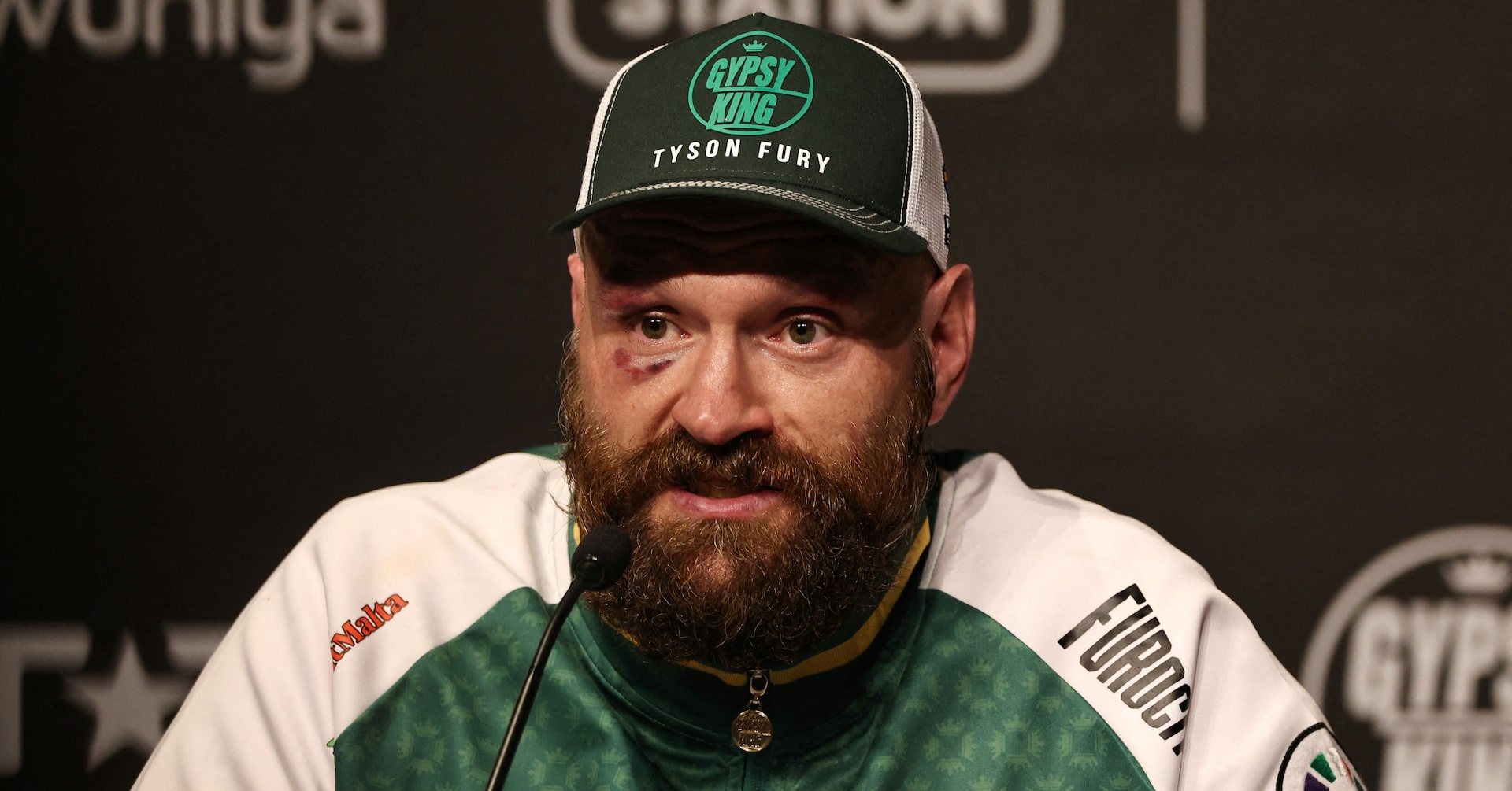 Fury confirms comeback fight against Makhmudov in April