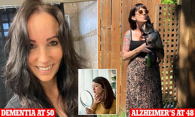 The surprising facial feature that can reveal if you will get dementia