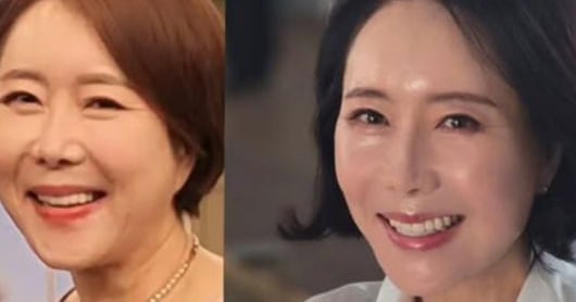 64-Year-Old Yoon Young-mi Transforms With Facial Lifting