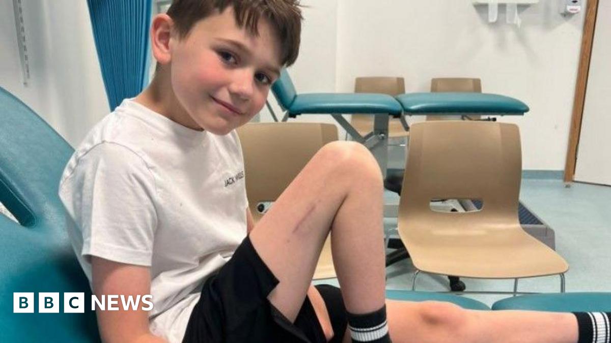 Boy, 9, in UK-first surgery to make him taller
