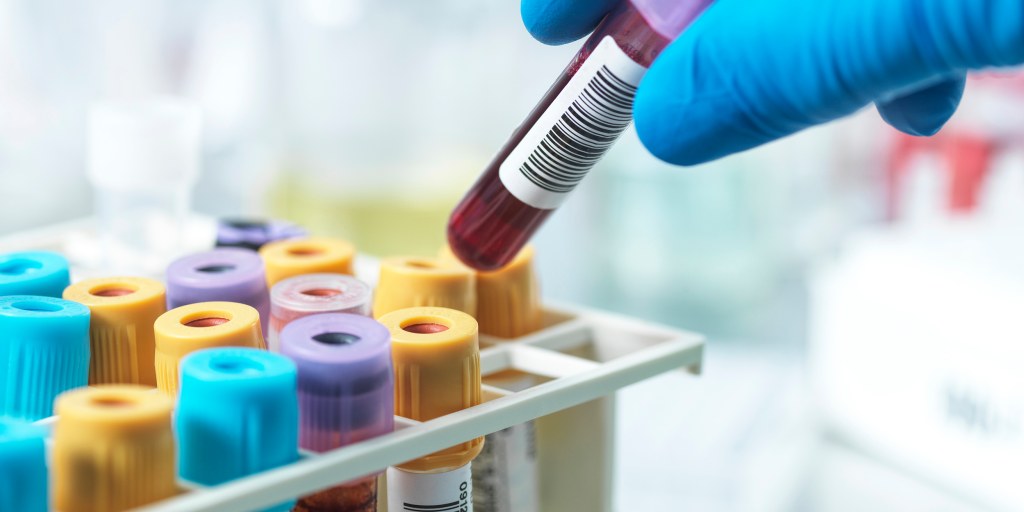 Is this blood test a better predictor of heart disease than LDL cholesterol?