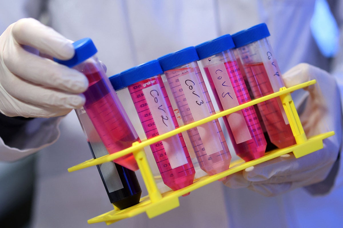 Long Covid could trigger symptoms similar to Alzheimer's, new study says